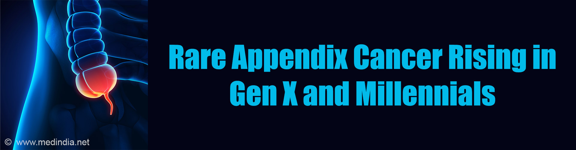 Appendix Cancer Rising Sharply in Young Adults