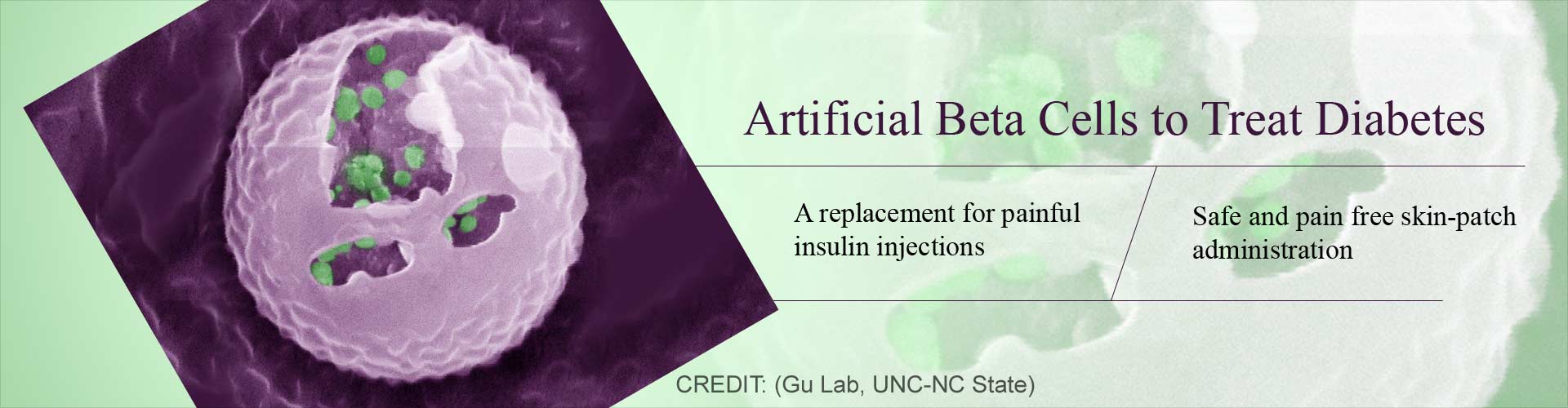 Artificial Beta Cells - the Way Forward for Diabetes Treatment Artificial Beta Cells - the Way Forward for Diabetes Treatment