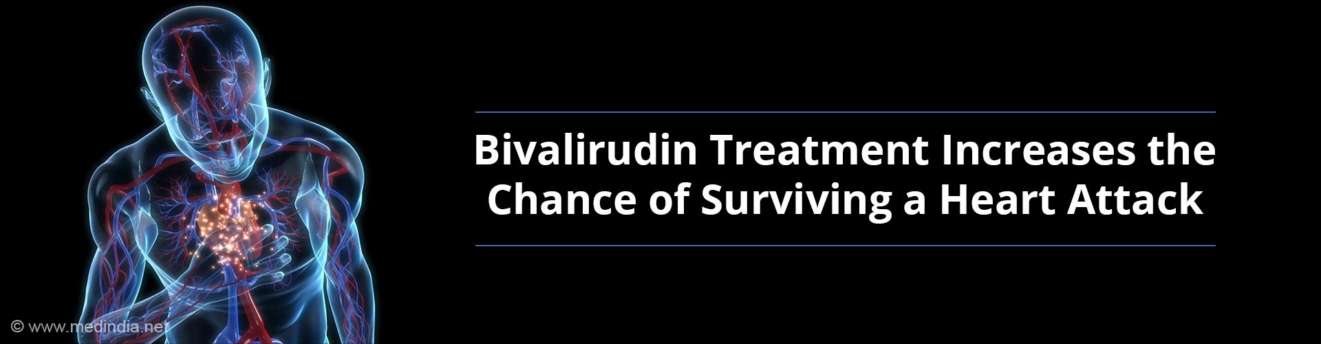 Heart Attack Patients Benefit from Bivalirudin Treatment