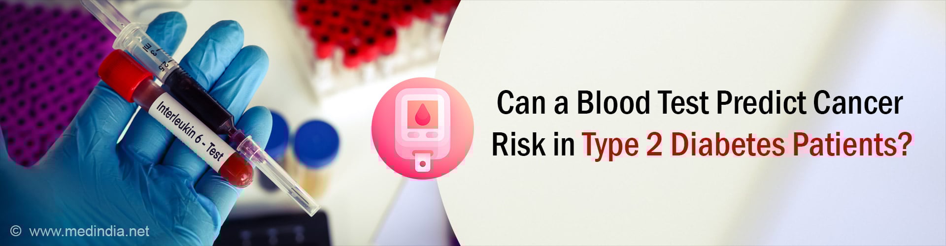 Higher Interlukin-6 (IL-6) in Blood Can Predict Cancer Risk in People With Type 2 Diabetes