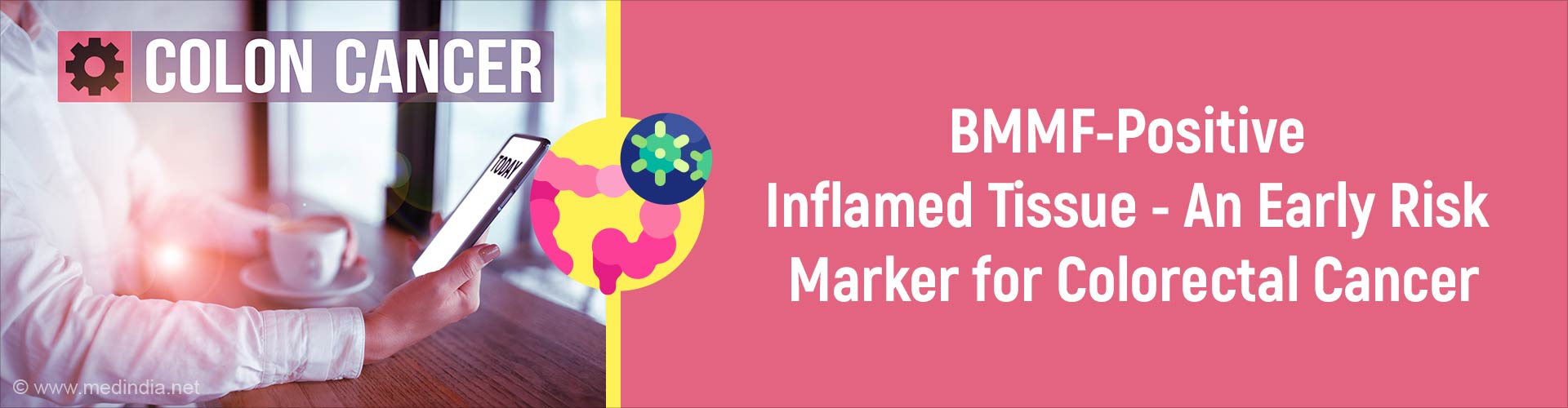 Role of Bovine Meat and Milk Factors in Colorectal Cancer