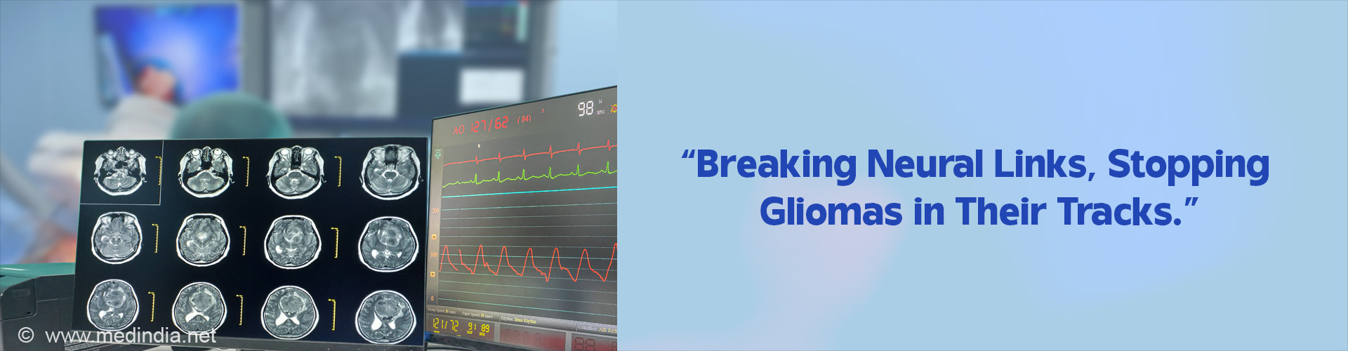 New Research Sheds Light on Why Brain Tumors Recur