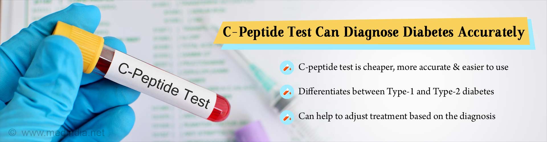 CPeptide Test Helps Diagnose and Treat Diabetes Accurately