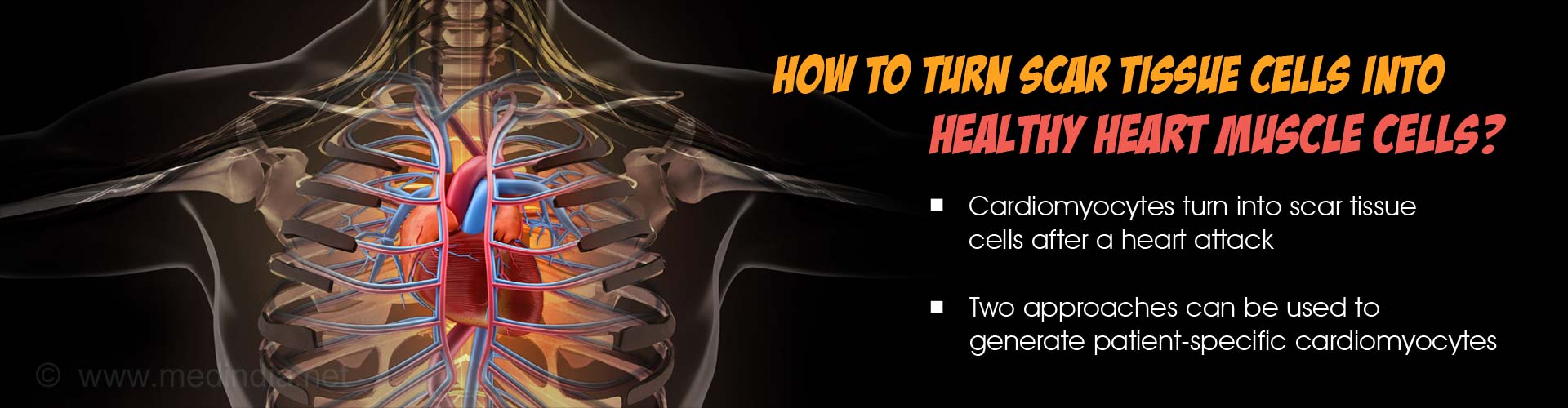 Can Scar Tissue After a Heart Attack be Turned Back into Functioning Heart Muscle? Can Scar Tissue After a Heart Attack be Turned Back into Functioning Heart Muscle?