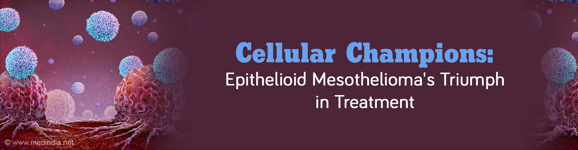 Epithelioid Tumors Have Improved Chemotherapy Response