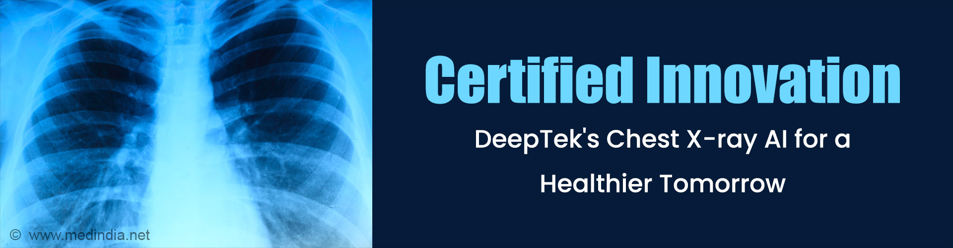 DeepTekâ€™s Chest X-ray AI Achieves EU MDR Certification