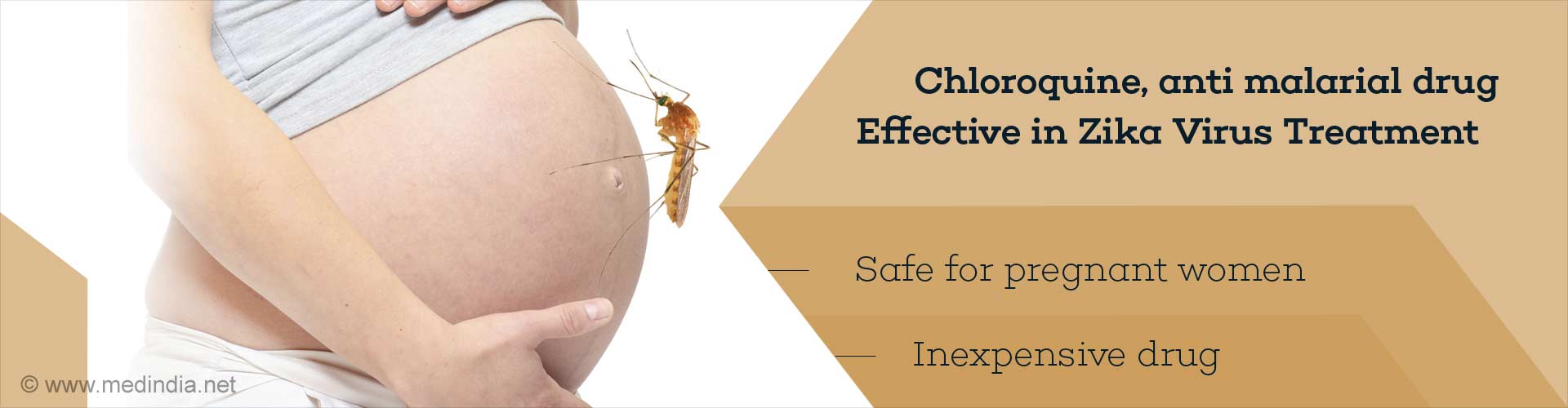Chloroquine, can be an Effective Zika Virus Treatment