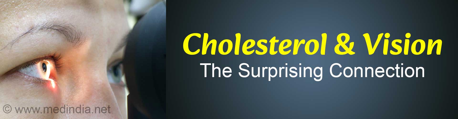 Can High 'Good' Cholesterol Increase Glaucoma Risk?