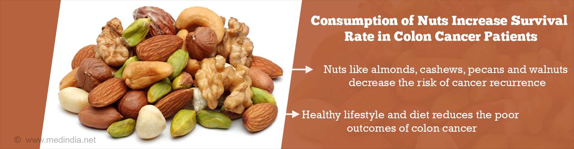 Eating Nuts Increases Survival Rate of Colon Cancer Patients