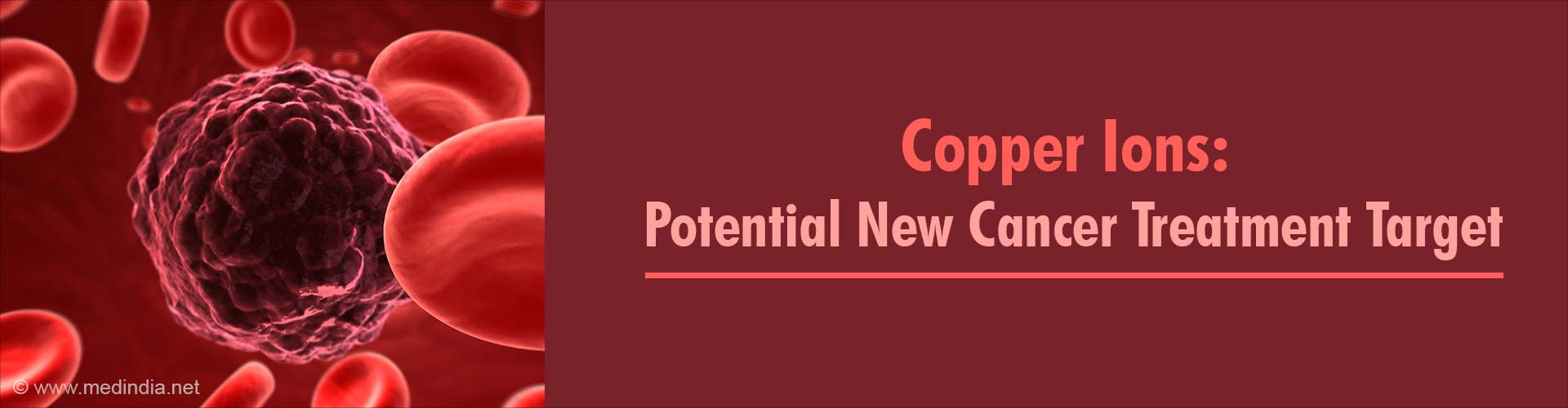 Copper Ions Could Possibly be the New Target in Cancer Treatment Copper Ions Could Possibly be the New Target in Cancer Treatment