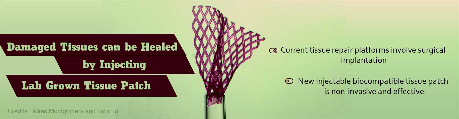 Injectable Tissue Patch - Revolutionary Concept In Repair Of Damaged Tissue Injectable Tissue Patch - Revolutionary Concept In Repair Of Damaged Tissue