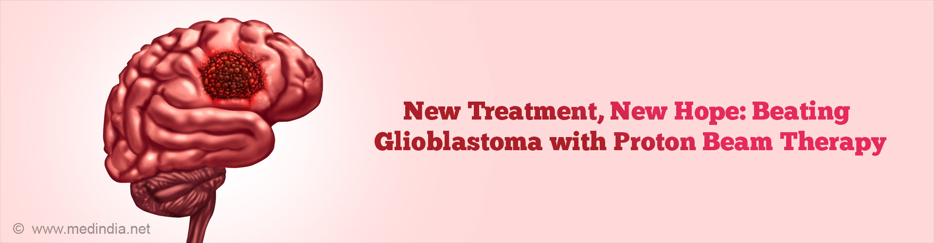 Promising New Approach in Treating the Deadliest Brain Cancer