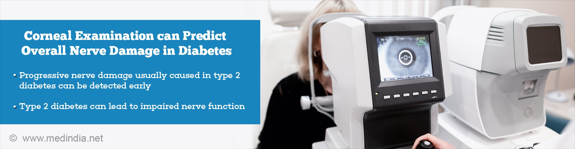 Diabetes Induced Nerve Damage can be Detected Early in the Eye Diabetes Induced Nerve Damage can be Detected Early in the Eye