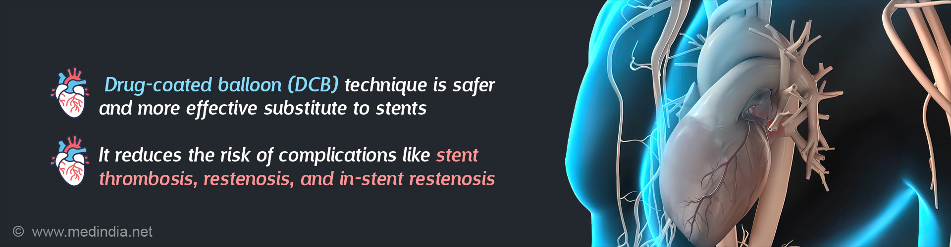 Drug-Coated Balloon Technique Can Replace Stent Usage Drug-Coated Balloon Technique Can Replace Stent Usage