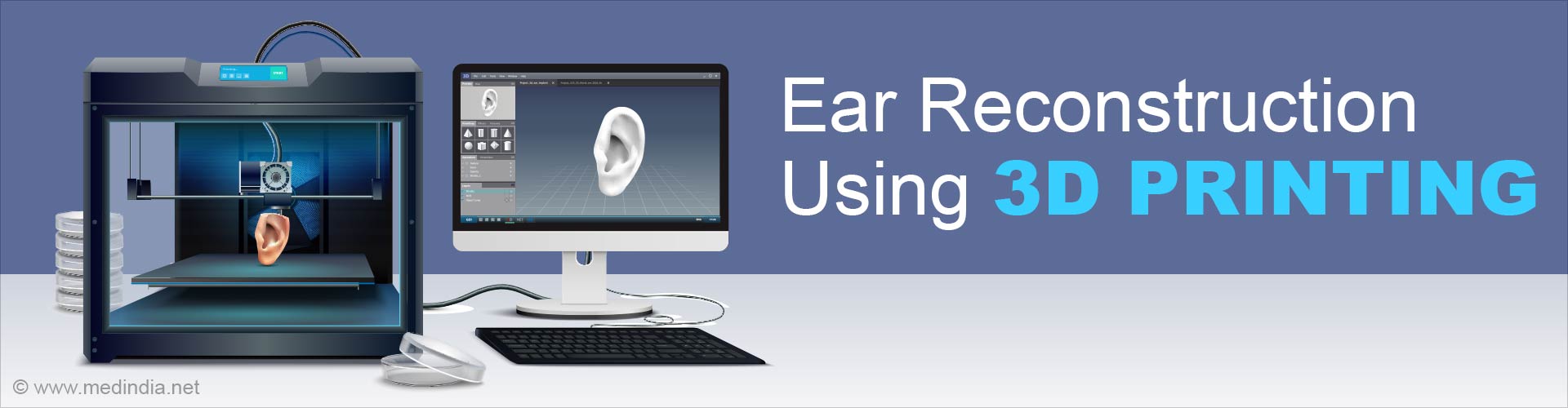 Lifelike Replica of Adult Human Ear Using 3D Printing