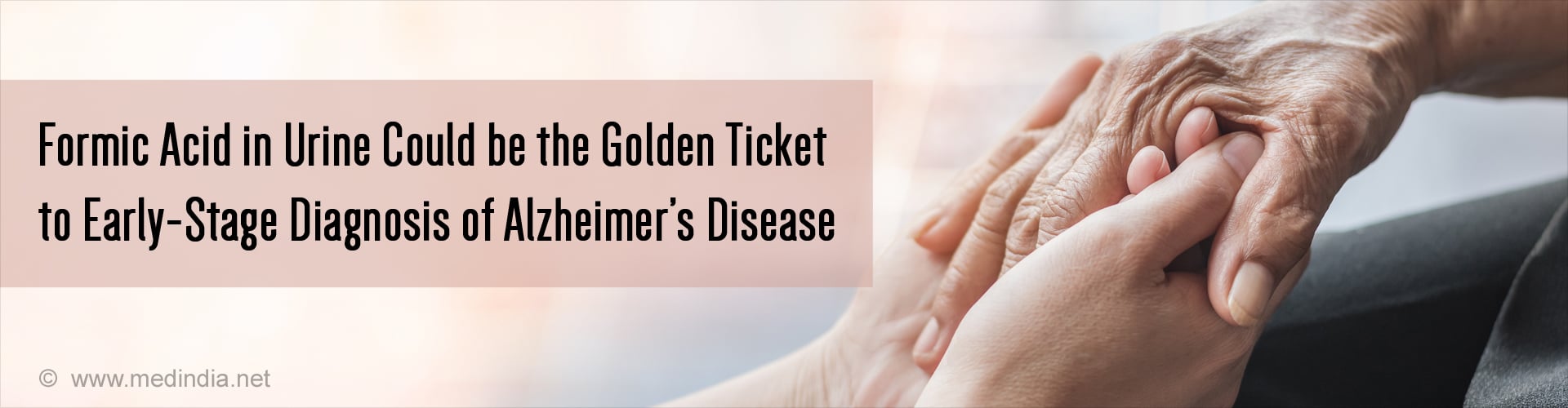 Early-Stage Alzheimer’s Disease Can be Detected Using a Molecule in Urine Early-Stage Alzheimer’s Disease Can be Detected Using a Molecule in Urine