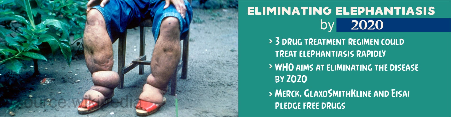Eliminating Elephantiasis by 2020