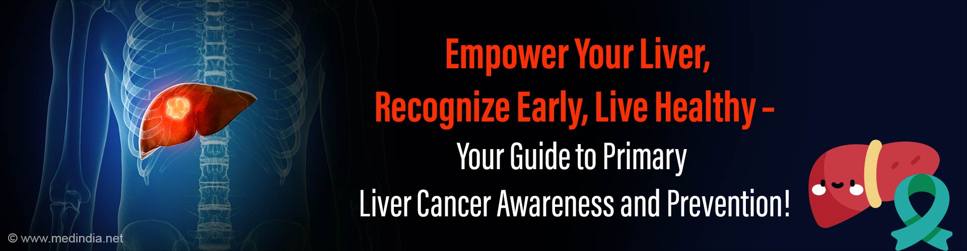 Primary Liver Cancer: Guide for Hepatocellular Carcinoma