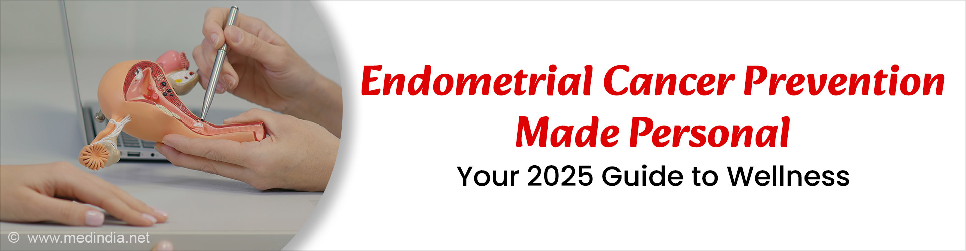 Guide to Endometrial Cancer Prevention: What Every Woman Needs to Know Guide to Endometrial Cancer Prevention: What Every Woman Needs to Know