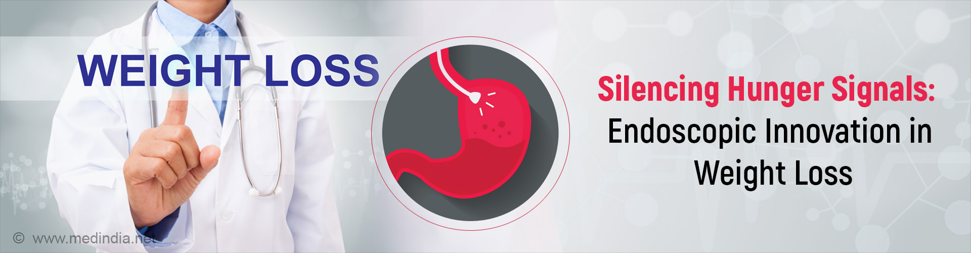 Can Endoscopic Procedure Help in Weightloss by Targeting Hunger Hormones? Can Endoscopic Procedure Help in Weightloss by Targeting Hunger Hormones?