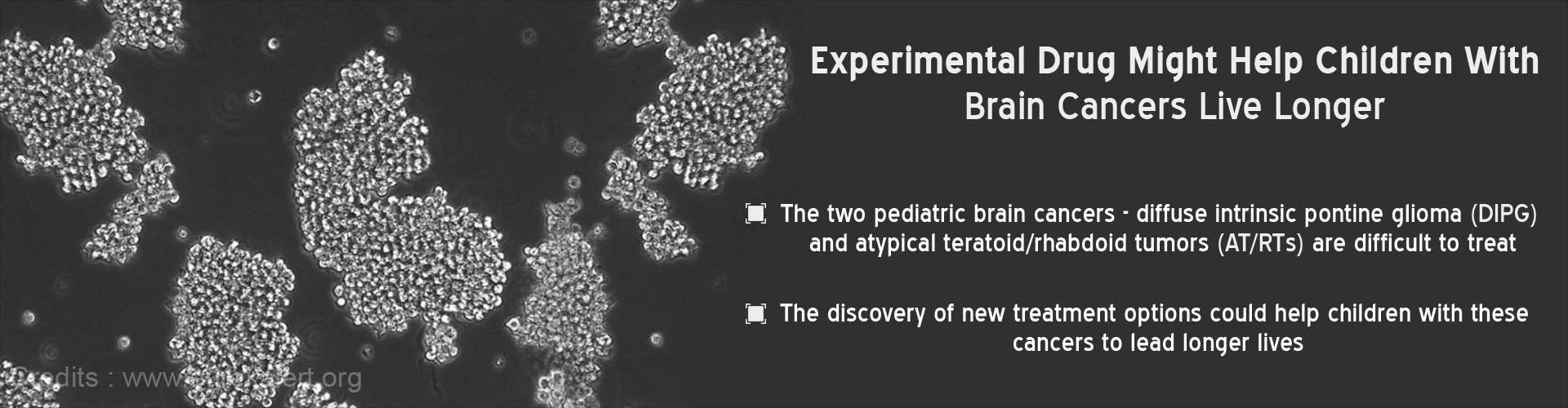 Children With Brain Cancers Might Find New Hope With Experimental Drug TAK228 Children With Brain Cancers Might Find New Hope With Experimental Drug TAK228