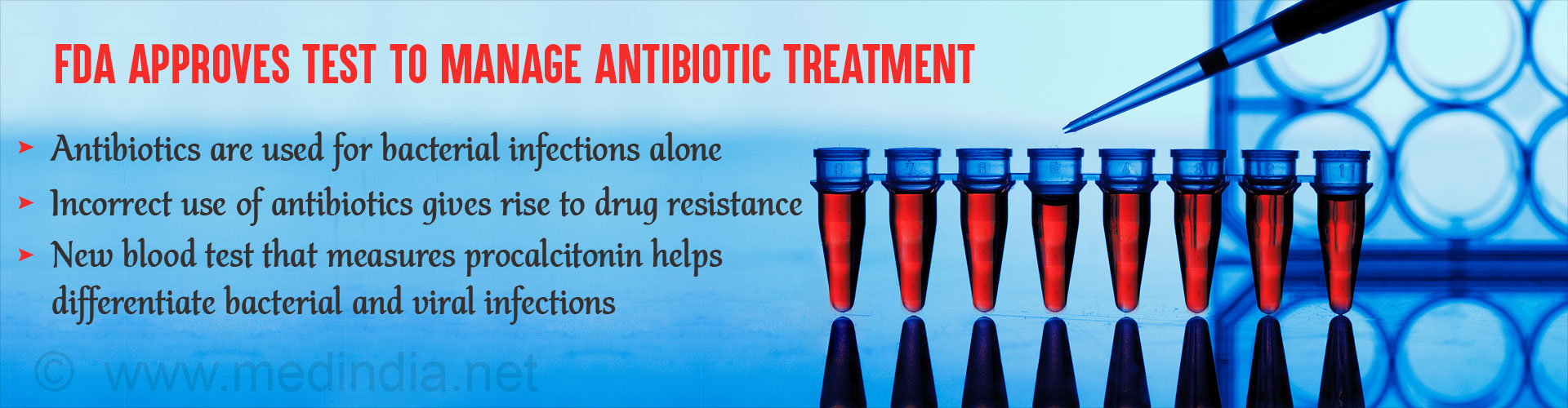 FDA Approves Test to Determine the Need for Antibiotics in Certain Infections