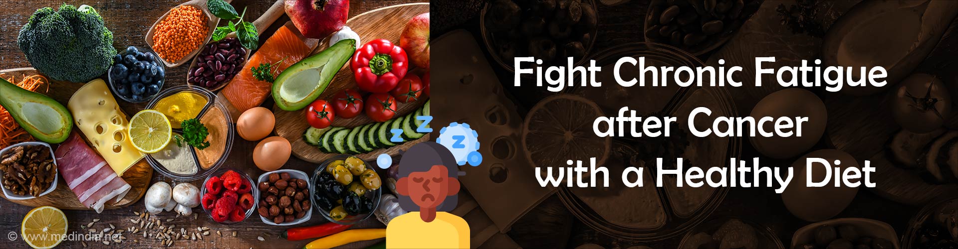 Chronic Fatigue in Cancer Survivors can be Fought With a Healthy Diet Chronic Fatigue in Cancer Survivors can be Fought With a Healthy Diet