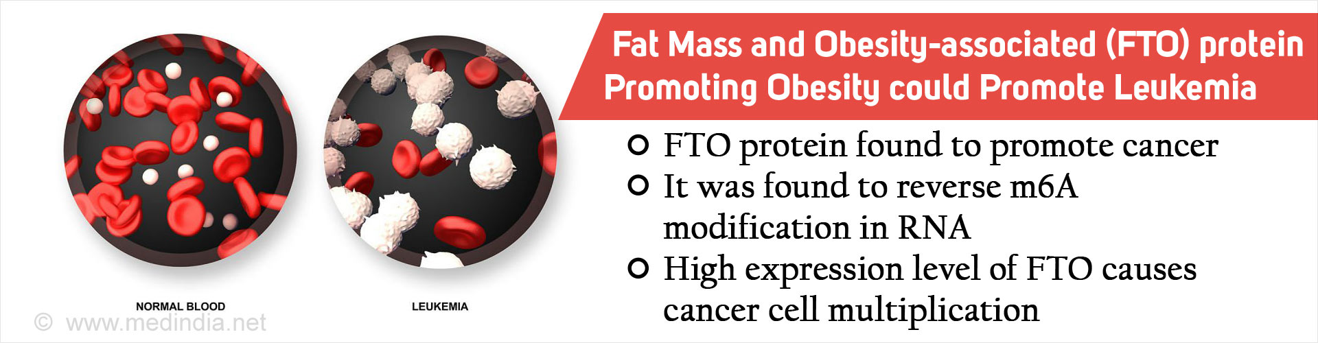 Fat Mass and Obesity-associated (FTO) Protein Linked to Leukemia Risk
