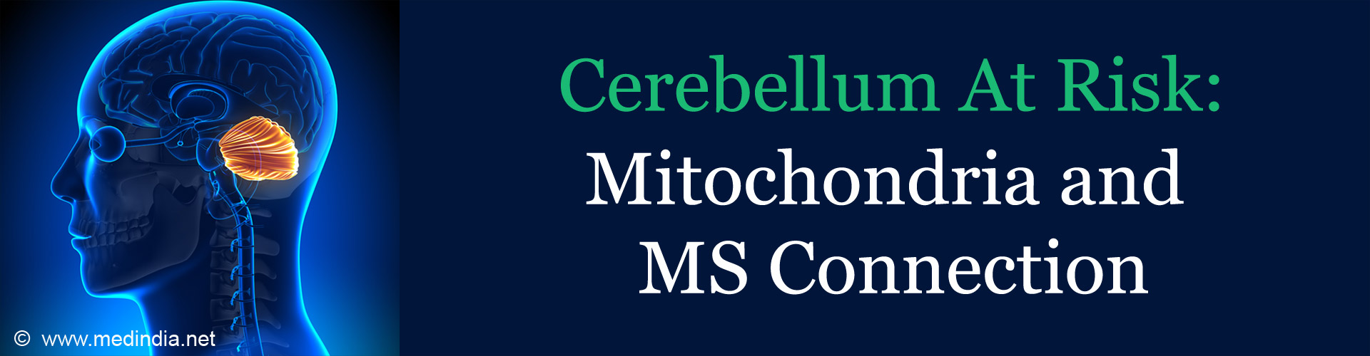 What Fuels Brain Damage in MS? Scientists Find Clues What Fuels Brain Damage in MS? Scientists Find Clues
