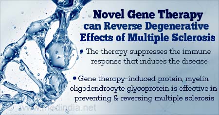 Gene Therapy Method Reverses Immune Response in Multiple Sclerosis