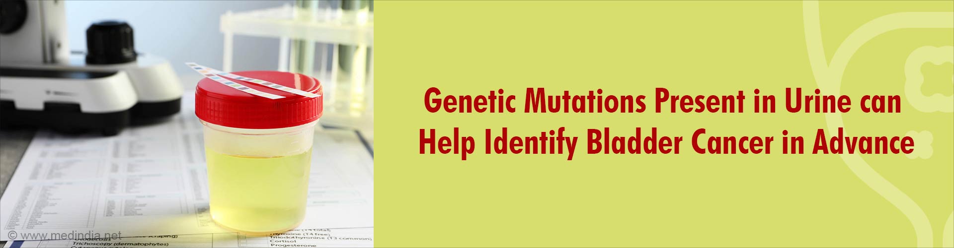 Urine Gene Test Could be the Next Tool to Predict Bladder Cancer