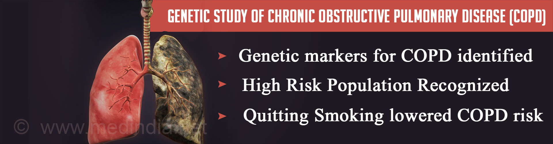 Predicting Risk for Chronic Obstructive Pulmonary Disease Predicting Risk for Chronic Obstructive Pulmonary Disease