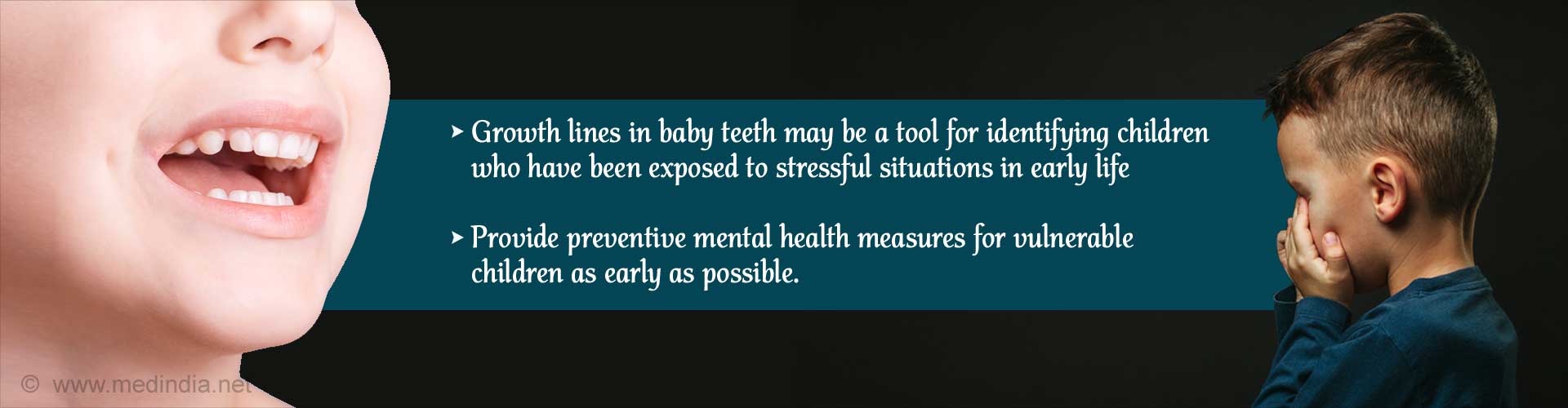Baby Teeth May Signal Mental Health Disorder Risk in Later Life Baby Teeth May Signal Mental Health Disorder Risk in Later Life