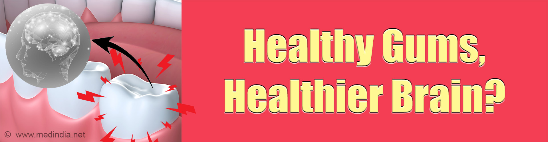 Can Gum Disease Harm Your Brain Health?