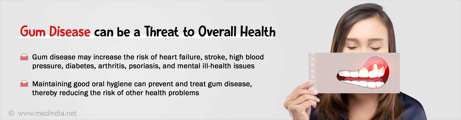 Gum Disease Boosts the Risk of Mental Health Problems