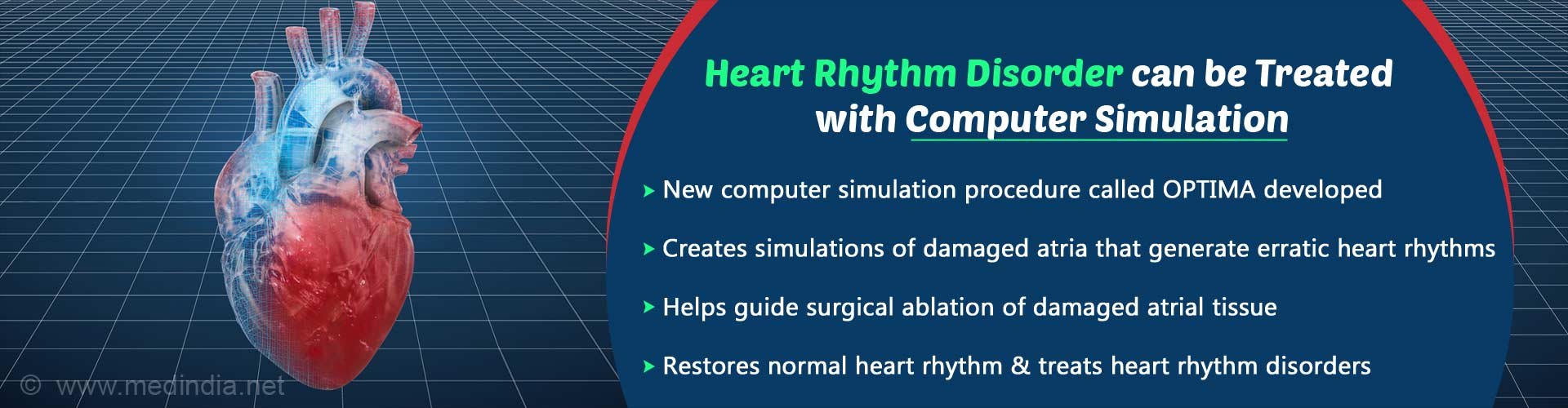 New Procedure Helps Treat Most Common Heart Rhythm Disorder New Procedure Helps Treat Most Common Heart Rhythm Disorder