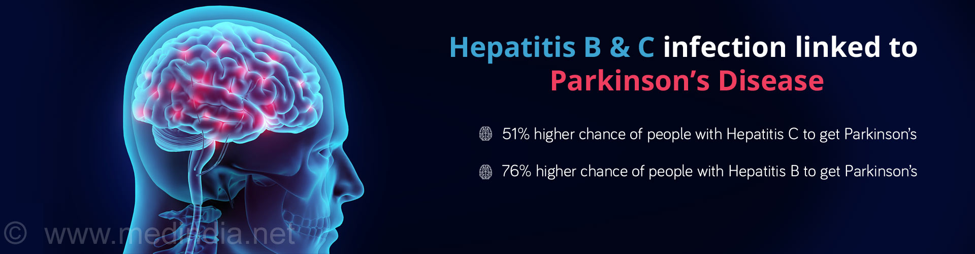 Parkinson’s Disease Risk High Among Hepatitis B and C Patients