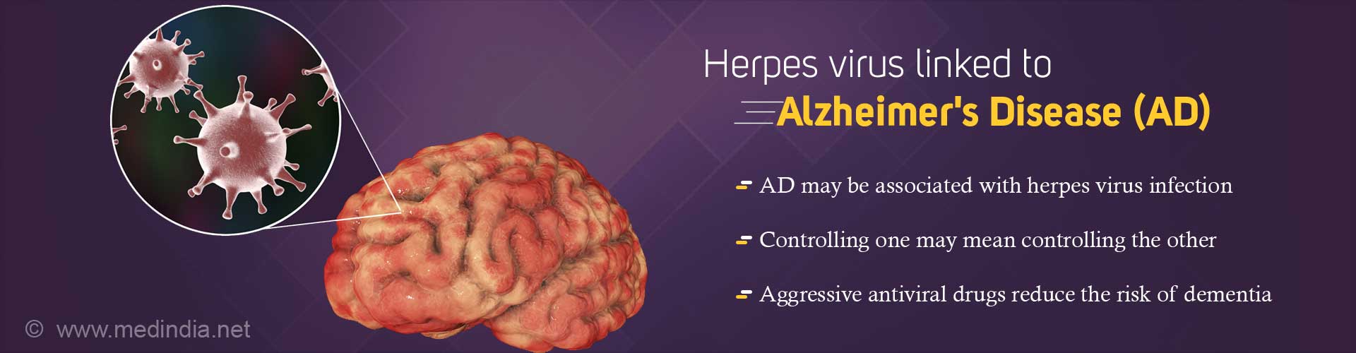 Herpes – A Risk for Alzheimer''s Disease