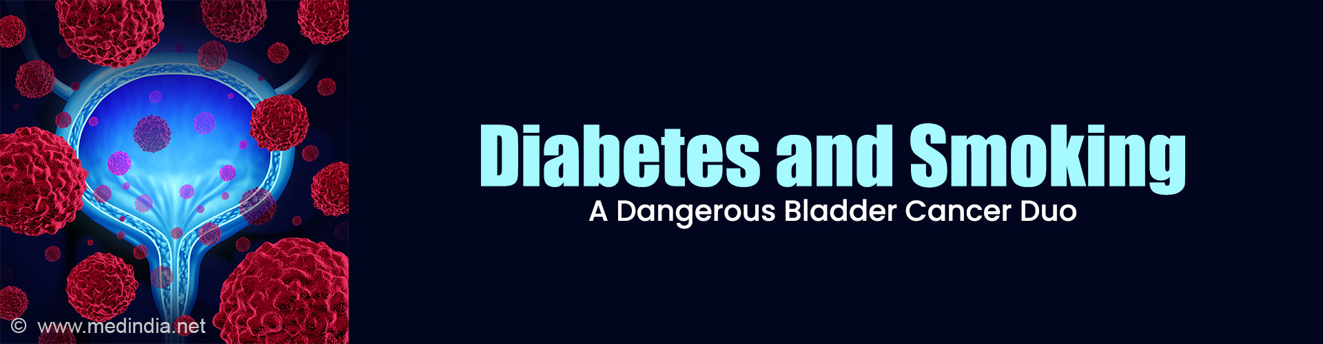 Diabetes Associated With Higher Bladder Cancer Risk