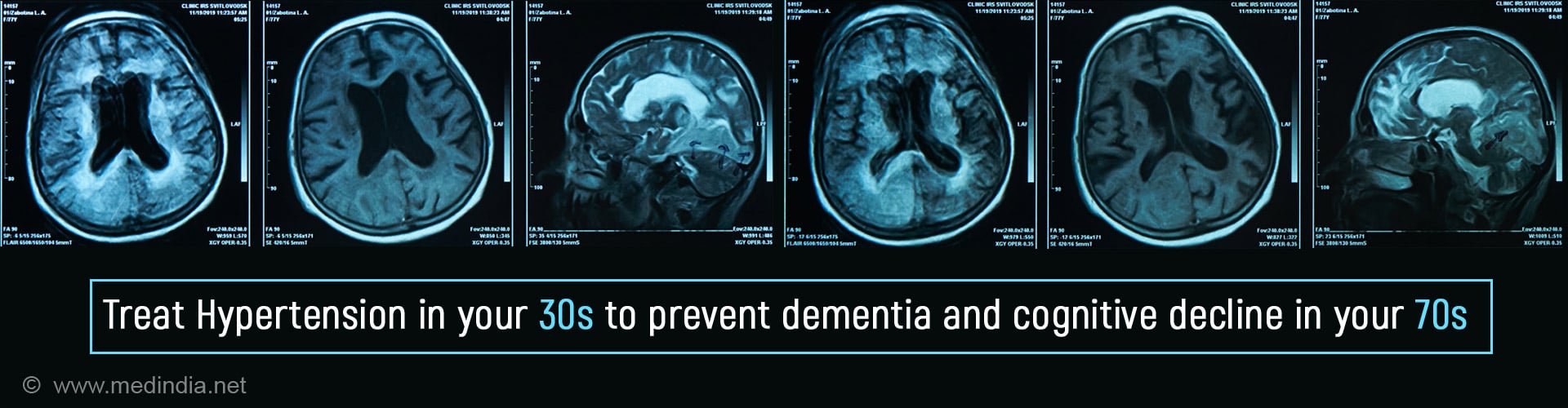 High BP in Your 30s Could Lead to Declining Brain Health in Your 70s High BP in Your 30s Could Lead to Declining Brain Health in Your 70s
