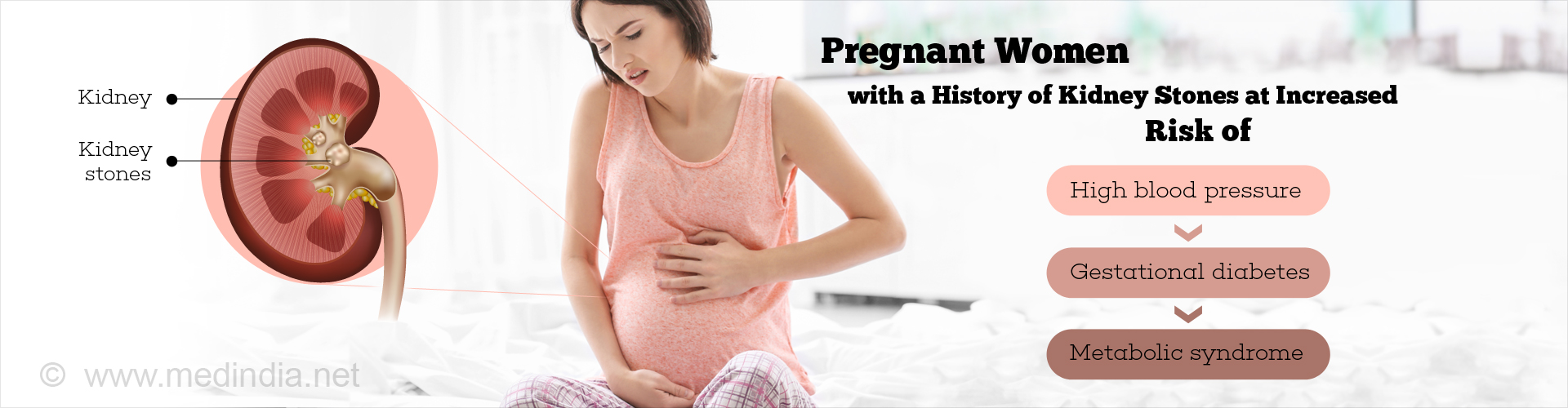 History of Kidney Stones may Cause Issues in Pregnancy