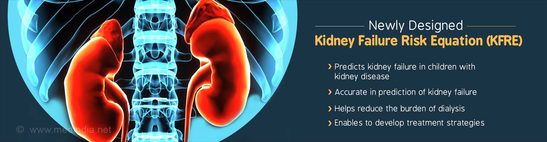 Kidney Failure Prediction Tool To Speed Up Transplantation Process