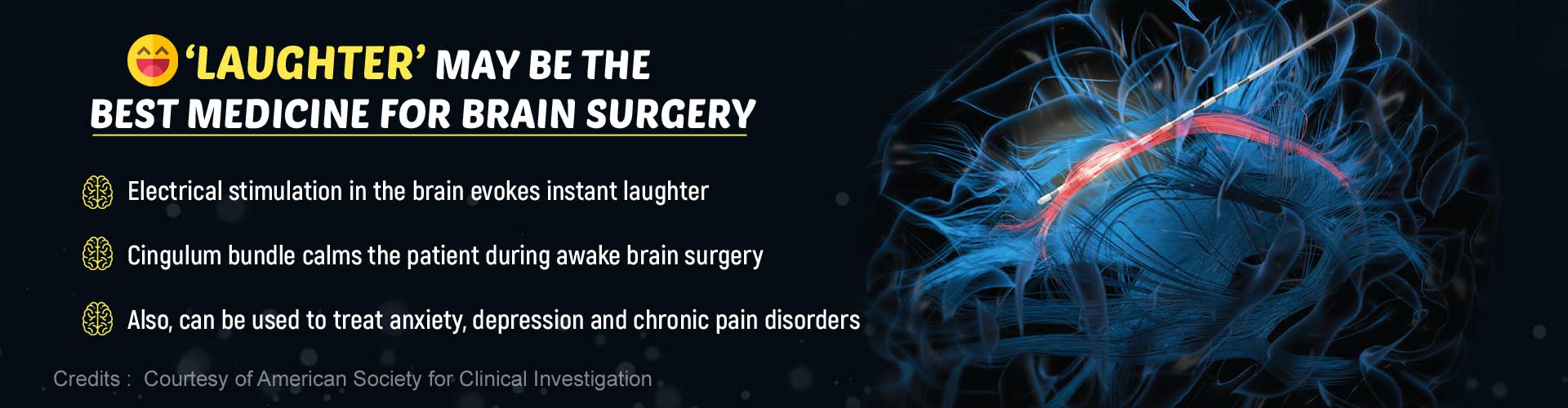 Laughter Helps Keep Patients Calm During Brain Surgery