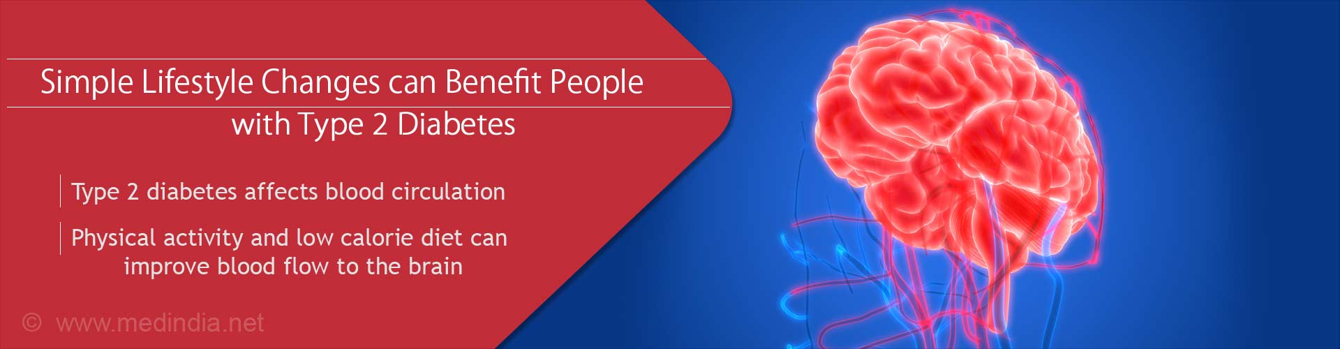 Lifestyle Changes Can Improve Blood Circulation in Type 2 Diabetes Lifestyle Changes Can Improve Blood Circulation in Type 2 Diabetes