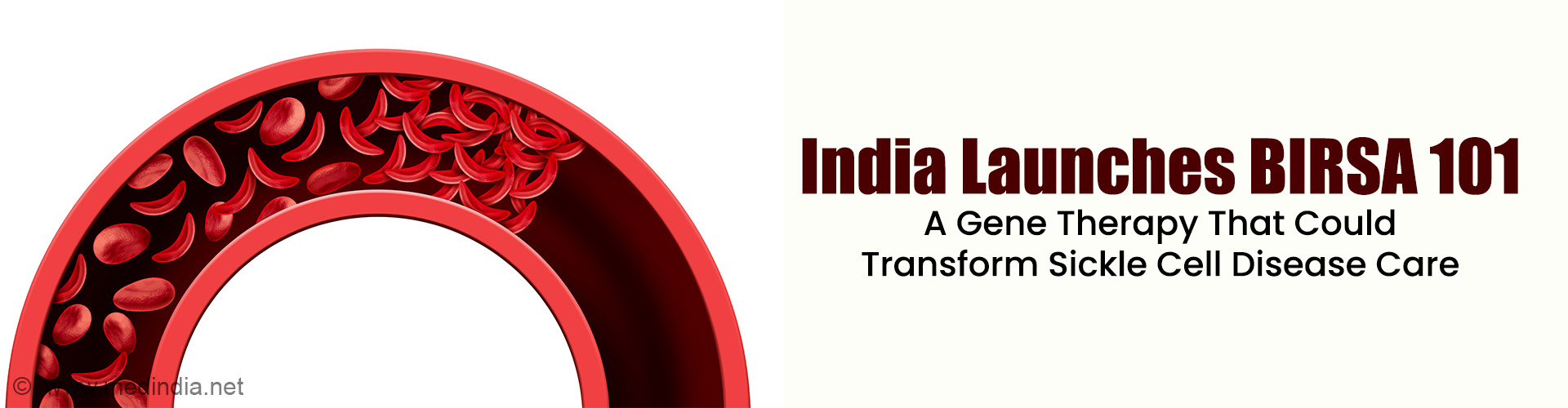 India's First Low-Cost CRISPR Gene Therapy Targets Sickle Cell Disease