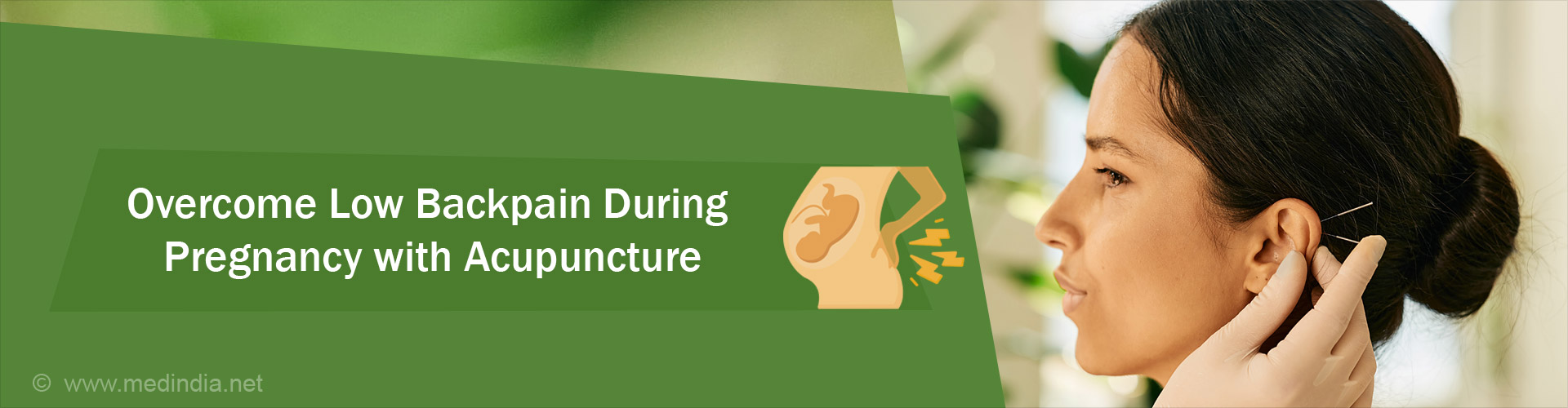 Acupuncture Safely Relieves Low Back Pain in Pregnant Women