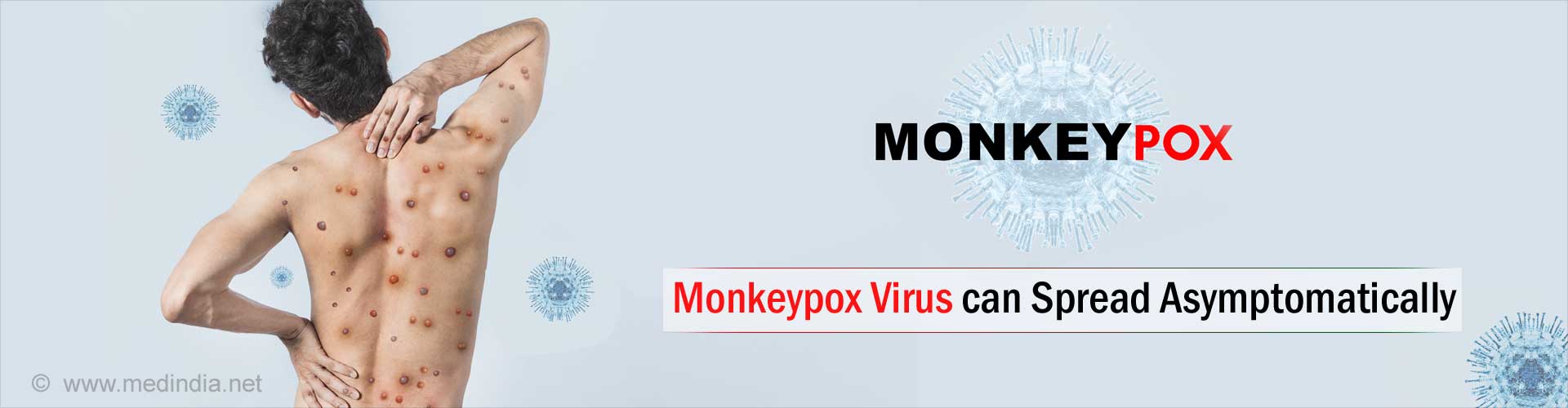 Monkeypox Virus Detected in Asymptomatic Patients