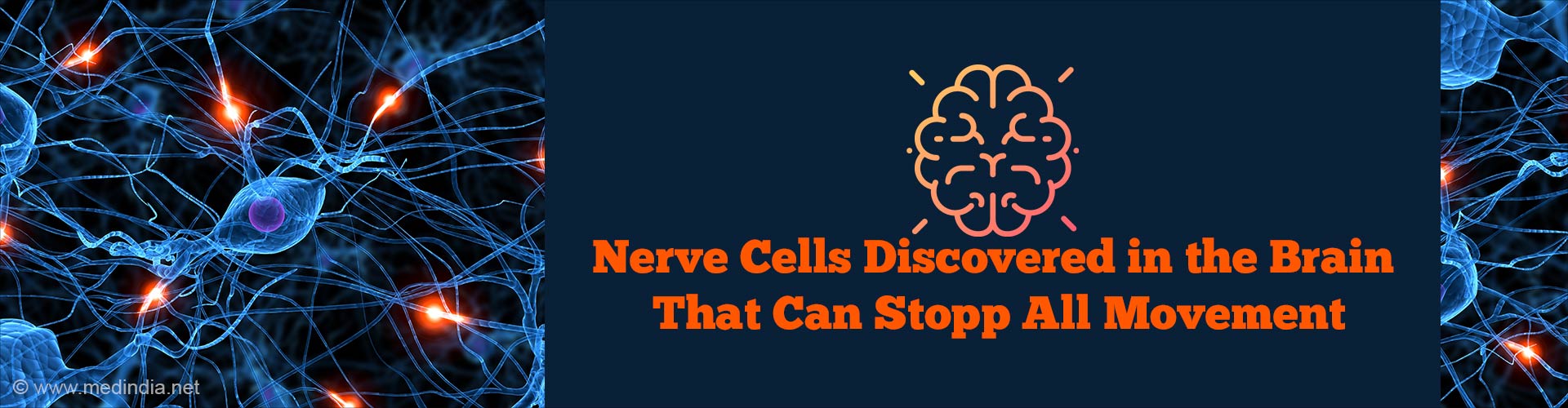 Does the Brain Have a 'Pause' Button to Freeze All Movements?