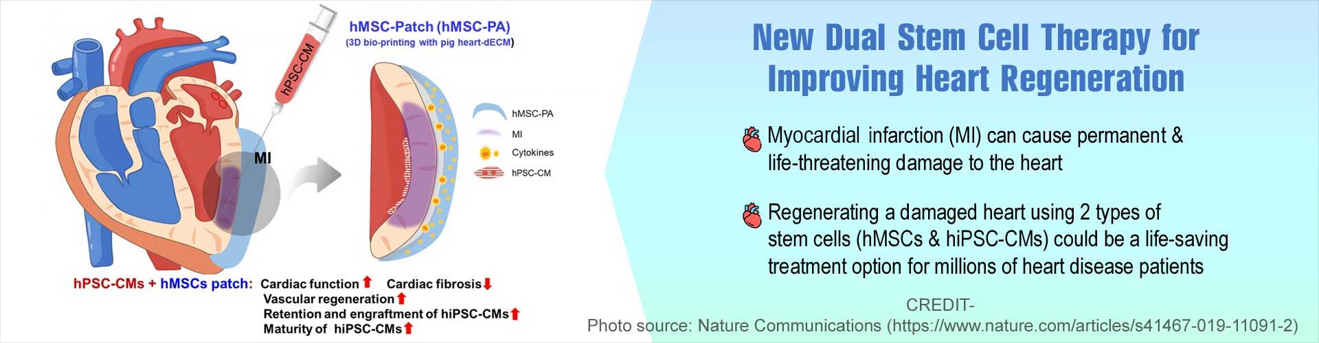 New Dual Stem Cell Therapy Holds Promise for Heart Regeneration
