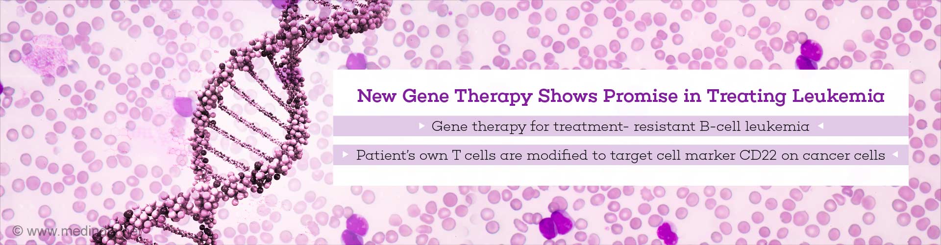 Gene Therapy To Treat Treatment- Resistant B-cell Leukemia